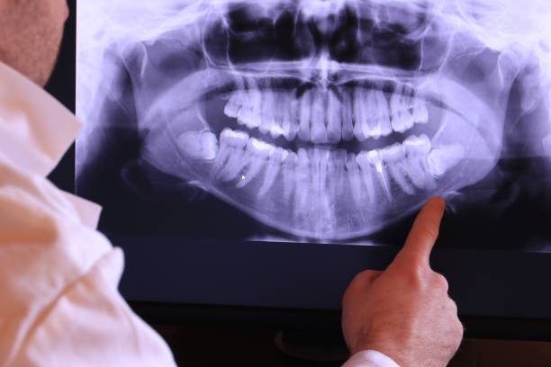 Best Emergency Root Canal Treatment in Veneta, OR